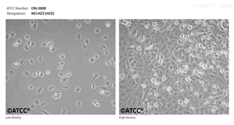 人非小细胞肺癌细胞 NCI-H23